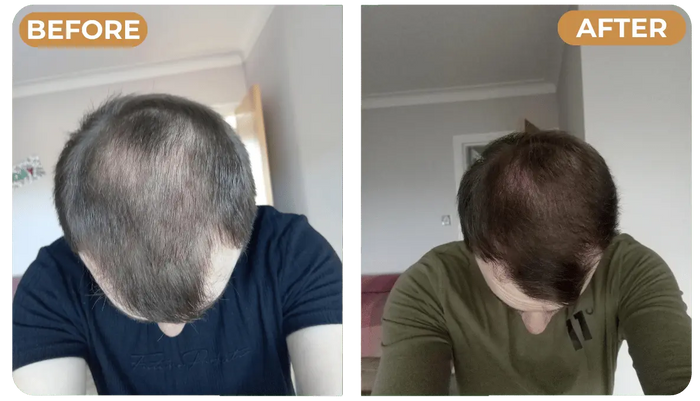 Before photo