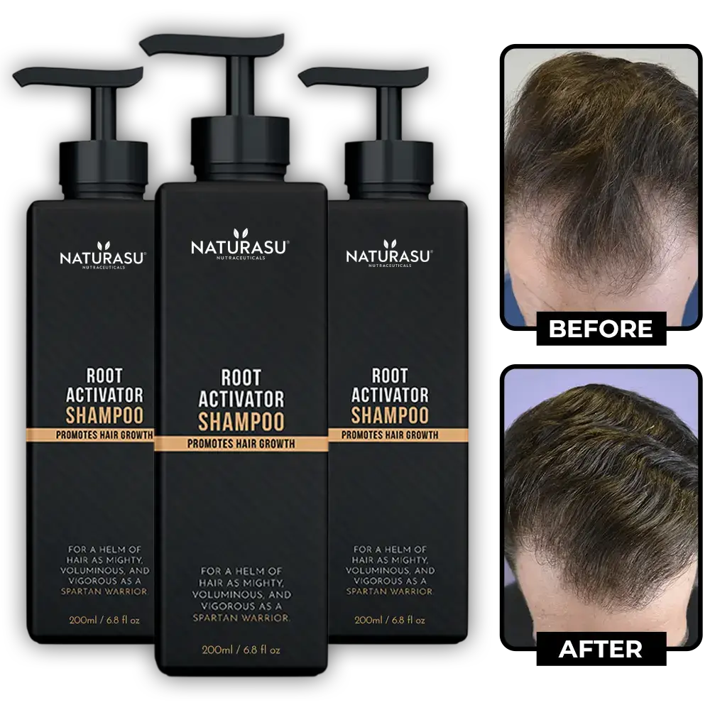 Spartan Root Activator Shampoo